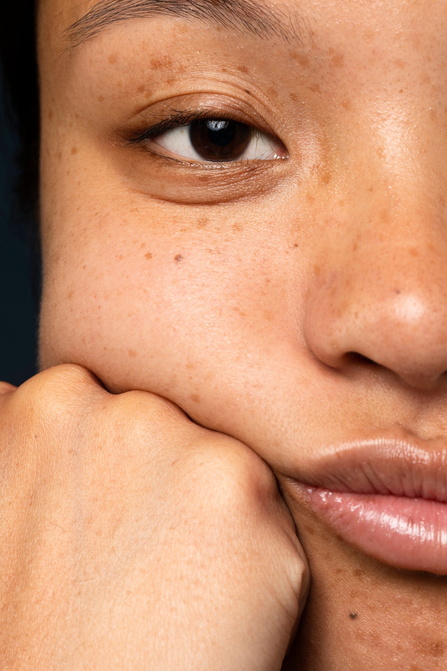 Dark Spots